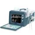 Precio de la máquina del ultrasonido protable 2D y el mejor precio para la máquina ultrasónica móvil